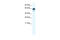 Cholinergic Receptor Nicotinic Alpha 1 Subunit antibody, 28-216, ProSci, Enzyme Linked Immunosorbent Assay image 