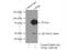 CD2 Associated Protein antibody, 51046-1-AP, Proteintech Group, Immunoprecipitation image 