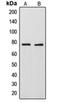 Rho GTPase-activating protein 18 antibody, orb215341, Biorbyt, Western Blot image 