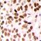 Mediator Complex Subunit 23 antibody, LS-C368856, Lifespan Biosciences, Immunohistochemistry paraffin image 