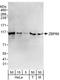 Zinc Finger Protein 148 antibody, A303-117A, Bethyl Labs, Western Blot image 