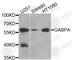 GA Binding Protein Transcription Factor Subunit Alpha antibody, A8419, ABclonal Technology, Western Blot image 