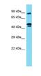 Radial Spoke Head Component 4A antibody, orb326682, Biorbyt, Western Blot image 