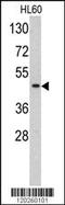 TATA-Box Binding Protein antibody, MBS9202997, MyBioSource, Western Blot image 