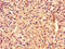 Rho Guanine Nucleotide Exchange Factor 12 antibody, LS-C675081, Lifespan Biosciences, Immunohistochemistry paraffin image 