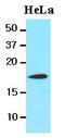Cofilin 1 antibody, MBS200127, MyBioSource, Western Blot image 