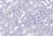 Interleukin 2 Receptor Subunit Beta antibody, NBP2-34148, Novus Biologicals, Immunohistochemistry paraffin image 