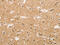 Nuclear Factor, Erythroid 2 Like 1 antibody, CSB-PA690633, Cusabio, Immunohistochemistry paraffin image 