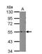 Rho GTPase Activating Protein 36 antibody, NBP2-15453, Novus Biologicals, Western Blot image 