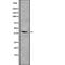 ST3 Beta-Galactoside Alpha-2,3-Sialyltransferase 3 antibody, abx218778, Abbexa, Western Blot image 