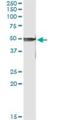 Protein Kinase X-Linked antibody, H00005613-M01, Novus Biologicals, Immunoprecipitation image 
