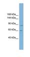 TBC1 Domain Containing Kinase antibody, orb330630, Biorbyt, Western Blot image 