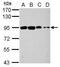 Oxysterol Binding Protein Like 9 antibody, GTX121551, GeneTex, Western Blot image 