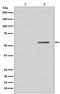 Phosphatase And Tensin Homolog antibody, P00006, Boster Biological Technology, Western Blot image 