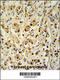 Small Cell Adhesion Glycoprotein antibody, 61-866, ProSci, Immunohistochemistry paraffin image 