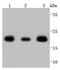 Superoxide Dismutase 2 antibody, NBP2-67879, Novus Biologicals, Western Blot image 