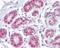 Apurinic/Apyrimidinic Endodeoxyribonuclease 1 antibody, NB100-56359, Novus Biologicals, Immunohistochemistry paraffin image 