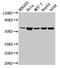 Cytochrome P450 Family 4 Subfamily F Member 22 antibody, LS-C674677, Lifespan Biosciences, Western Blot image 