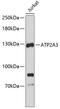 Sarcoplasmic/endoplasmic reticulum calcium ATPase 3 antibody, 19-146, ProSci, Western Blot image 