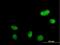 Glyoxylate Reductase 1 Homolog antibody, H00084656-B01P, Novus Biologicals, Immunofluorescence image 