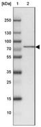 ATP Binding Cassette Subfamily F Member 2 antibody, NBP1-89318, Novus Biologicals, Western Blot image 