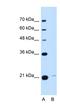 Transmembrane P24 Trafficking Protein 3 antibody, NBP1-62563, Novus Biologicals, Western Blot image 