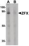 Zinc Finger Protein X-Linked antibody, PA5-34376, Invitrogen Antibodies, Western Blot image 