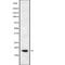 Killer Cell Lectin Like Receptor C2 antibody, abx217180, Abbexa, Western Blot image 