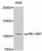 RB Transcriptional Corepressor 1 antibody, abx125454, Abbexa, Western Blot image 