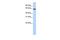 UPF3B Regulator Of Nonsense Mediated MRNA Decay antibody, GTX47228, GeneTex, Western Blot image 