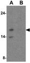 Hes Family BHLH Transcription Factor 5 antibody, GTX31605, GeneTex, Western Blot image 