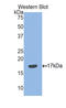 Semaphorin 3F antibody, LS-C304534, Lifespan Biosciences, Western Blot image 