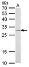 NAD(P)H Quinone Dehydrogenase 1 antibody, GTX113336, GeneTex, Western Blot image 