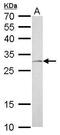 DT-diaphorase antibody, GTX113336, GeneTex, Western Blot image 
