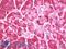 Microtubule Associated Protein 1 Light Chain 3 Beta antibody, LS-B10153, Lifespan Biosciences, Immunohistochemistry paraffin image 