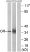 Olfactory Receptor Family 4 Subfamily D Member 6 antibody, LS-C120870, Lifespan Biosciences, Western Blot image 