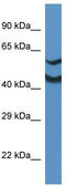 NDRG Family Member 2 antibody, TA342552, Origene, Western Blot image 