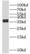 RRAD And GEM Like GTPase 2 antibody, FNab07237, FineTest, Western Blot image 