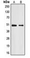 E2F Transcription Factor 2 antibody, orb213866, Biorbyt, Western Blot image 