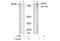 Eukaryotic Translation Initiation Factor 4 Gamma 1 antibody, AP08034PU-N, Origene, Western Blot image 