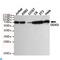 DEAD-Box Helicase 3 X-Linked antibody, LS-C812940, Lifespan Biosciences, Western Blot image 