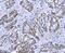 Minichromosome Maintenance Complex Component 7 antibody, M01649-3, Boster Biological Technology, Immunohistochemistry paraffin image 