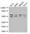 Insulin Like Growth Factor 2 MRNA Binding Protein 3 antibody, CSB-PA011092LA01HU, Cusabio, Western Blot image 