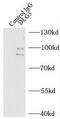 Discs Large MAGUK Scaffold Protein 3 antibody, FNab02410, FineTest, Immunoprecipitation image 