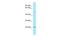 Endothelin-3 antibody, A03272, Boster Biological Technology, Western Blot image 