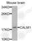 Calmodulin antibody, A1185, ABclonal Technology, Western Blot image 