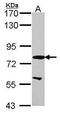 EMAP Like 1 antibody, PA5-30016, Invitrogen Antibodies, Western Blot image 
