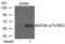 Docking Protein 1 antibody, PA5-37548, Invitrogen Antibodies, Western Blot image 