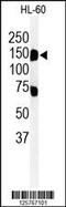 Transmembrane 131 Like antibody, 61-733, ProSci, Western Blot image 