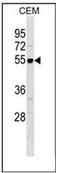 RB Binding Protein 7, Chromatin Remodeling Factor antibody, AP53600PU-N, Origene, Western Blot image 